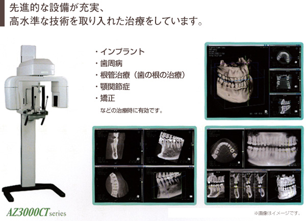 CT�摜