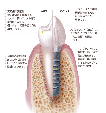 �C���v�����g�����摜